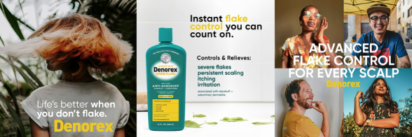 Denorex Launches its New Severe Flakes Anti-Dandruff Shampoo + Conditioner with 2X Flake-Fighting Power
